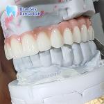 Artificial Dental Implant Case Multiple Sterilization Implant Cases