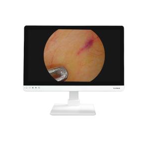 China 4K FHD Medical Equipment 27 Inch Endoscope Camera Monitor Display For Endoscope factory