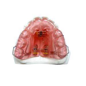 China Custom Removable OEM Fixed Orthodontic Appliance Good Durability factory