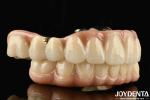 Excellent Strength Ti-Bar Zirconia Hybrid Bridge For Natural Teeth And Gums
