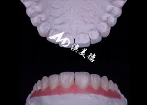 China Translucency EMAX Porcelain Veneer Resistant to Stains / Strength factory