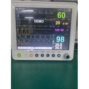Portable Patient Monitor With Parameters Of ETCO2 ECG NIBP SPO2 RESP TEMP PR