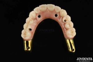 China Wear Resistance Zirconia Hybrid Bridge With Ti-Bar Compatible Natural Teeth And Gums factory