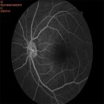 35mm Fundus Imaging System Equipment Auto Focus Shooting