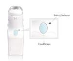 Monitor Treatment and Prevent Recurrence Digital Electronic Colposcope Self -