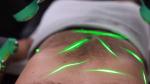 10D Cold Laser Therapy Machine Green Diode Light Emerald Laser Liposuction