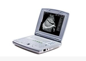 China Portable Baby Ultrasound Machine Portable Ultrasound Scanner for Pediatrics factory