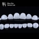 Sleek Premium Veneer Cases 0.3mm Ultra Thin Emax Veneers