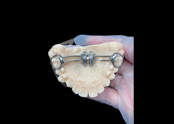 MSE Palatal Expander Innovative Orthodontic Appliances For Effective Teeth