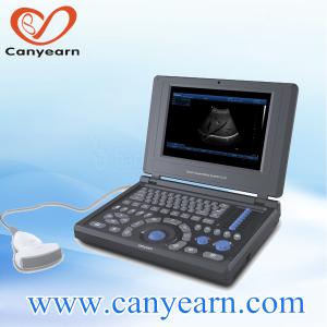 cheapest named 3D/4D medical laptop ultrasound machine/device in China
