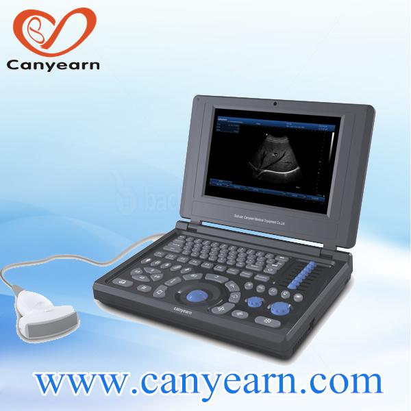 China cheapest named 3D/4D medical laptop ultrasound machine/device in China factory
