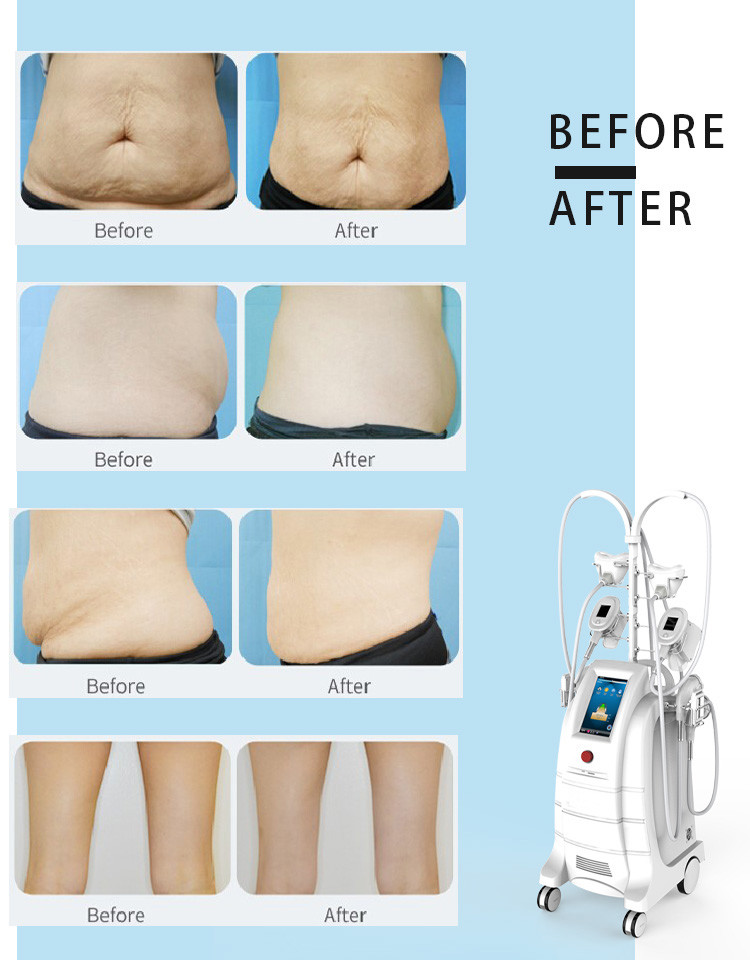 LF-202A Newest 7 handles multifunctional cellulite reduction cryo slimming machine with double chin