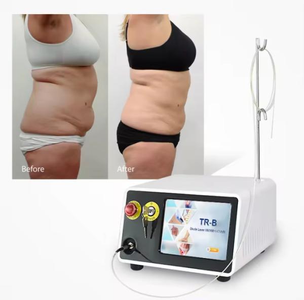 Professional 1470nm Diode Laser Fat Reduction Machine Visible Results In 2-3