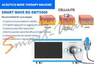 China 6 Transmitters Acoustic Wave Therapy Machine For Stretch Marks Removal / Body Reshaping factory