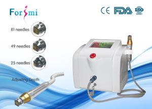 China Stretch mark removal beauty machine for sale 80W power 5Mhz frequency factory