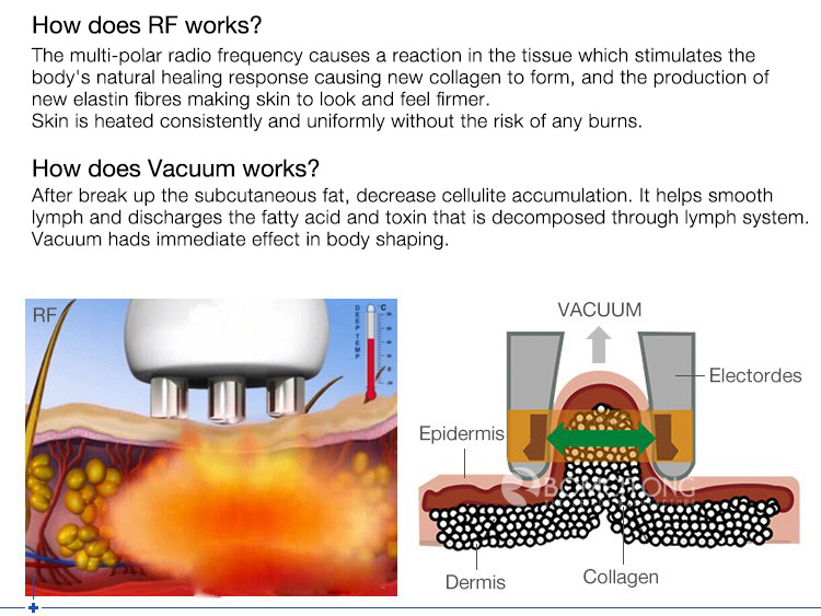 40khz Ultrasonic Cavitation Machine Facial Y Corporal Cavitation Vacuum Massage Bipolar Rf Fast Slimming