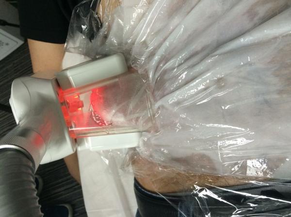 Anti Freeze Membranes for Cryolipolysis Fat Freezing slimming Machine