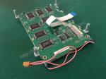 P/N 930 117 17 Defibrillator Machine Parts LCD Display Assembly
