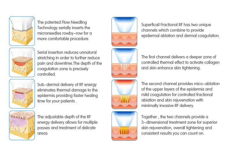 2019 online order free shipping rf fractional micro needle for lipolisis/wrinkles/acne removal