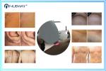 12*20mm Big Spot Size Painless 808nm Diode Laser Hair Removal Machine