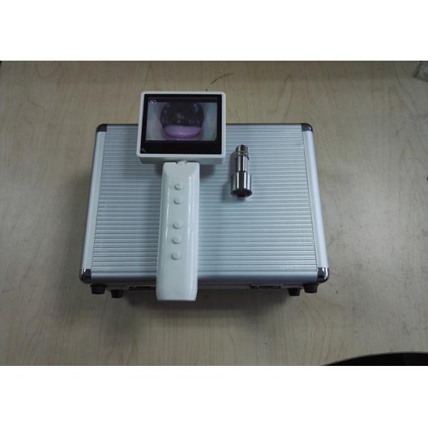 Video USB AV Digital Otoscope Diagnostic Set Ear Camera For Ear Inspection