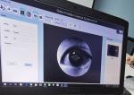 factory price for the auto Capture and Auto Flash Fundus Camera for Retinal