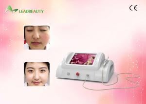 China Radio frequency Ablation Varicose Veins / Spider Vein Removal Painless 30Mhz factory