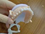 Natural Esthetics Layered Zirconia Crown Bridge For Beautiful Smile And Good