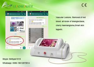 China 30MHz RBS blood vessel removal vascular lesion spider vein treatment machine factory