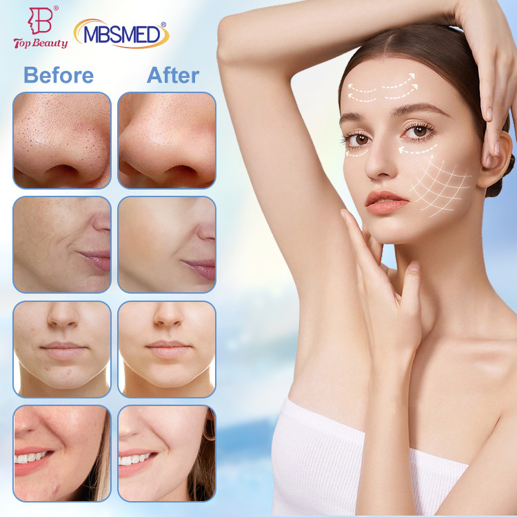 7 In1 Hydrafacial Machine Oxygen Facial Machine Nederland