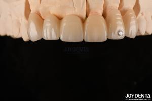 China CAD / CAM Milling Dental Layered Zirconia For Single Crowns 0.3-0.5mm Layer Thickness factory