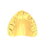 Gray 3d Dental Resin ASTM D256 ASTM D2204 Standards