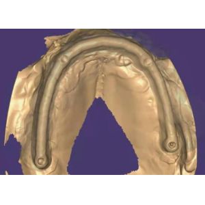 Zirconia Dental Crown: Natural-looking Teeth, Durable & Secure