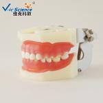 Professional Medical Dental Study Models VIC-L5 Peridontal Disease Model
