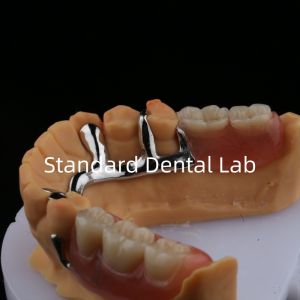 Alloy Metal Partial Denture Framework 3 Shape Exocad Laser Printing Lower Cast