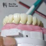 Universal Dental Implant Case Compatible With Multiple Implant Systems