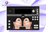 Wrinkle Removal Skin Rejuvenation Equipment Face Lifting Hifu Vertical Equipment