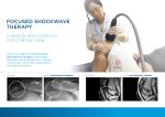 10bar Focused Extracorporeal Erectile Dysfunction Shock Wave Sale Shockwave