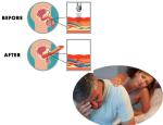 200mj Electromagnetic Pain Relief Eswt Ems Shockwave Machine