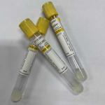 Gel Clot Activator Vacuum Blood Collection Tube Yellow Cap