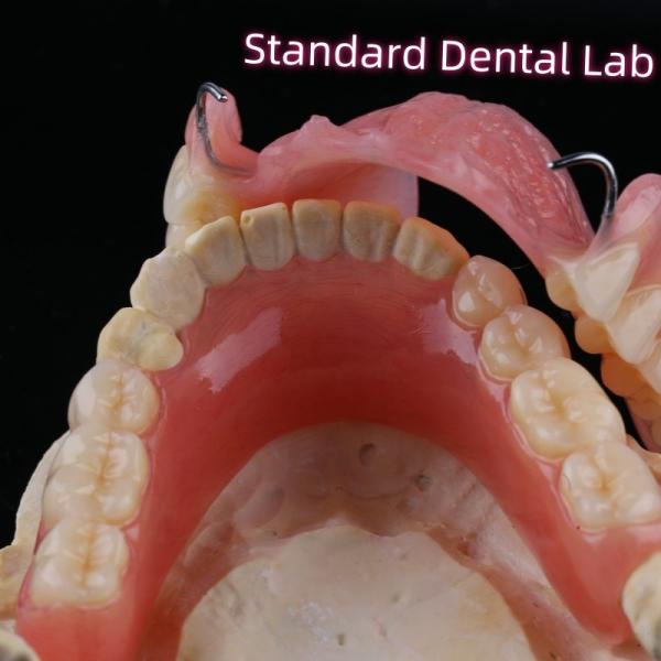 China Removable Dental Restorations Acrylic Partial Denture Teeth With Wire Clasps factory