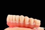 Natural Looking Acrylic Denture Finish High Biocompatibility With Tooth
