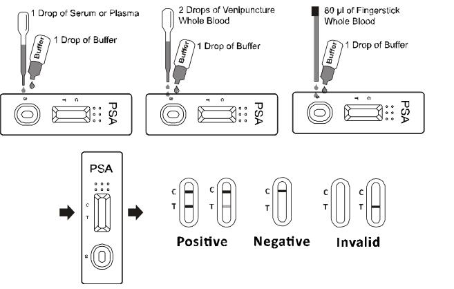 PSA Prostate Specific Antigen Test Kit Qualitative Medical Diagnosis