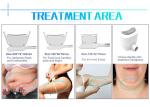 USA FDA approved most advanced Slimming tech cool body sculpting zeltiq fat
