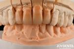 Polished Layered Zirconia White And Durable For Perfect Surface Finish