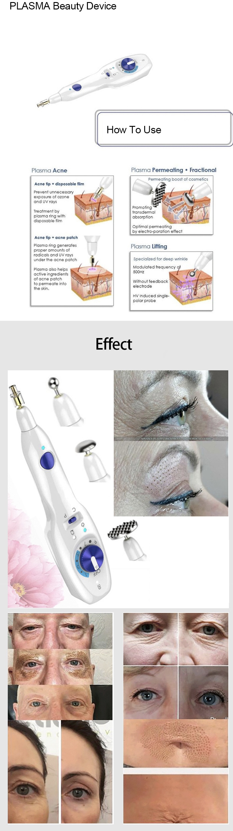 Skin Tightening Rejuvenation Eye Lifting 40khz Fibroblast Plasma Pen OEM