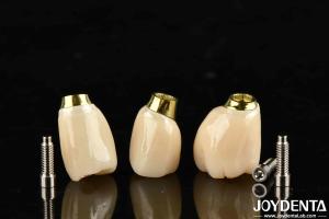 China High Durability White Finish Implant Crown And Bridge With Accurate Fit factory