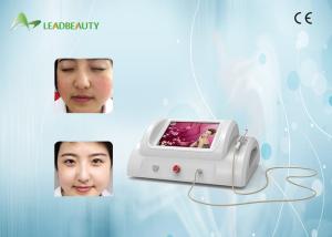 China RBS 30Mhz High Frequency Spider Vein Removal Machine For Vascular Removal factory
