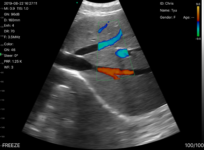 Double Head Transvaginal Array Wireless Ultrasound Probe 3.5MHZ
