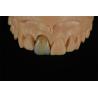 Buy cheap Affordable Zirconia Crowns with Custom Color Staining - China Dental Lab from wholesalers